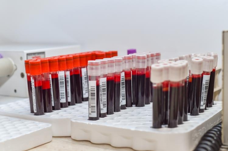 Jak współczesne leczenie odmieniło los chorych na hemofilię
